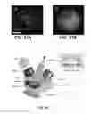 Fig. 20 - Device and method for in vivo noninvasive magnetic manipulation of circulating objects in bioflows