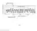 Fig. 05 - BIO INFORMATION MEASUREMENT DEVICE AND BIO INFORMATION MEASUREMENT METHOD