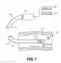 Fig. 02 - HIGH SPEED ELASTROGRAPHIC PROPERTY MAPPING OF LUMENS UTILIZING MICROPALPATION DELIVERED FROM AN OCT-EQUIPPED CATHETER TIP