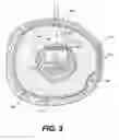Fig. 04 - HIGH SPEED ELASTROGRAPHIC PROPERTY MAPPING OF LUMENS UTILIZING MICROPALPATION DELIVERED FROM AN OCT-EQUIPPED CATHETER TIP