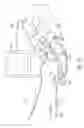 Fig. 21 - Physiological sensor delivery device and method