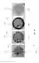 Fig. 15 - Systems and methods for cardiomyocyte conduction speed mapping