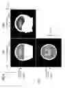 Fig. 05 - MAGNETIC RESONANCEIMAGING APPARATUS AND MEASUREMENT METHOD THEREOF