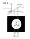 Fig. 06 - MAGNETIC RESONANCEIMAGING APPARATUS AND MEASUREMENT METHOD THEREOF