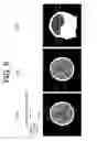 Fig. 07 - MAGNETIC RESONANCEIMAGING APPARATUS AND MEASUREMENT METHOD THEREOF