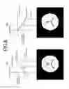 Fig. 10 - MAGNETIC RESONANCEIMAGING APPARATUS AND MEASUREMENT METHOD THEREOF