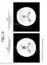 Fig. 16 - MAGNETIC RESONANCEIMAGING APPARATUS AND MEASUREMENT METHOD THEREOF