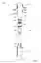 Fig. 04 - Fluid diversion mechanism for bodily-fluid sampling