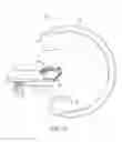 Fig. 05 - RADIAL ACCESS PROCEDURES AND DEVICES