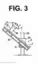 Fig. 04 - Radiographic device