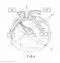 Fig. 05 - X-ray diagnostic apparatus