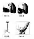 Fig. 02 - Method for determining a respiratory condition based on functional respiratory imaging