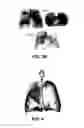 Fig. 04 - Method for determining a respiratory condition based on functional respiratory imaging