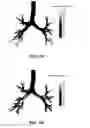 Fig. 06 - Method for determining a respiratory condition based on functional respiratory imaging