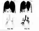 Fig. 09 - Method for determining a respiratory condition based on functional respiratory imaging