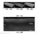 Fig. 11 - Integrated multimodality intravascular imaging system that combines optical coherence tomography, ultrasound imaging, and acoustic radiation force optical coherence elastography