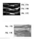 Fig. 12 - Integrated multimodality intravascular imaging system that combines optical coherence tomography, ultrasound imaging, and acoustic radiation force optical coherence elastography