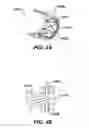 Fig. 04 - Devices for sealing a body lumen