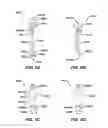 Fig. 06 - Devices for sealing a body lumen