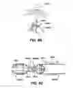 Fig. 09 - Devices for sealing a body lumen