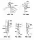 Fig. 12 - Devices for sealing a body lumen