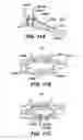 Fig. 13 - Devices for sealing a body lumen