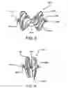 Fig. 07 - Sealing device and delivery system
