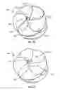 Fig. 08 - Sealing device and delivery system