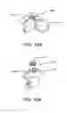 Fig. 15 - Sealing device and delivery system