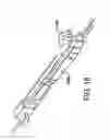Fig. 20 - Sealing device and delivery system