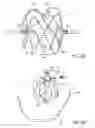 Fig. 25 - Sealing device and delivery system