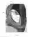 Fig. 43 - Sealing device and delivery system