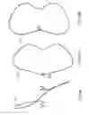 Fig. 44 - Sealing device and delivery system