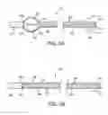 Fig. 11 - APPARATUS AND METHODS FOR SEALING A PUNCTURE IN TISSUE