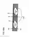 Fig. 102 - METHODS AND DEVICES TO DECREASE TISSUE TRAUMA DURING SURGERY