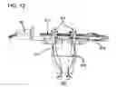 Fig. 11 - METHODS AND DEVICES TO DECREASE TISSUE TRAUMA DURING SURGERY
