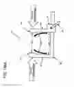 Fig. 129 - METHODS AND DEVICES TO DECREASE TISSUE TRAUMA DURING SURGERY