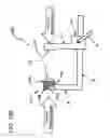 Fig. 134 - METHODS AND DEVICES TO DECREASE TISSUE TRAUMA DURING SURGERY