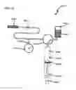 Fig. 147 - METHODS AND DEVICES TO DECREASE TISSUE TRAUMA DURING SURGERY