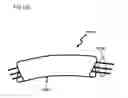 Fig. 148 - METHODS AND DEVICES TO DECREASE TISSUE TRAUMA DURING SURGERY