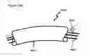 Fig. 149 - METHODS AND DEVICES TO DECREASE TISSUE TRAUMA DURING SURGERY