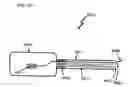Fig. 152 - METHODS AND DEVICES TO DECREASE TISSUE TRAUMA DURING SURGERY