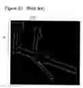 Fig. 32 - METHODS AND DEVICES TO DECREASE TISSUE TRAUMA DURING SURGERY