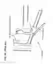 Fig. 42 - METHODS AND DEVICES TO DECREASE TISSUE TRAUMA DURING SURGERY