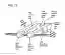 Fig. 87 - METHODS AND DEVICES TO DECREASE TISSUE TRAUMA DURING SURGERY