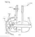 Fig. 90 - METHODS AND DEVICES TO DECREASE TISSUE TRAUMA DURING SURGERY