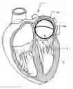 Fig. 01 - Temporary Atrium Support Device