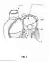 Fig. 03 - Temporary Atrium Support Device