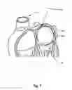 Fig. 08 - Temporary Atrium Support Device