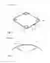 Fig. 02 - Device providing enlargement and preventing collapse of the pupil of the eye